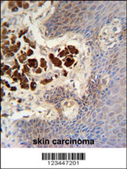 COL19A1 Antibody