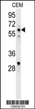 IKZF1 Antibody