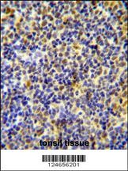 IKZF1 Antibody