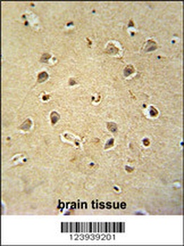 GABRG2 Antibody