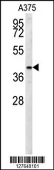 S35B2 Antibody