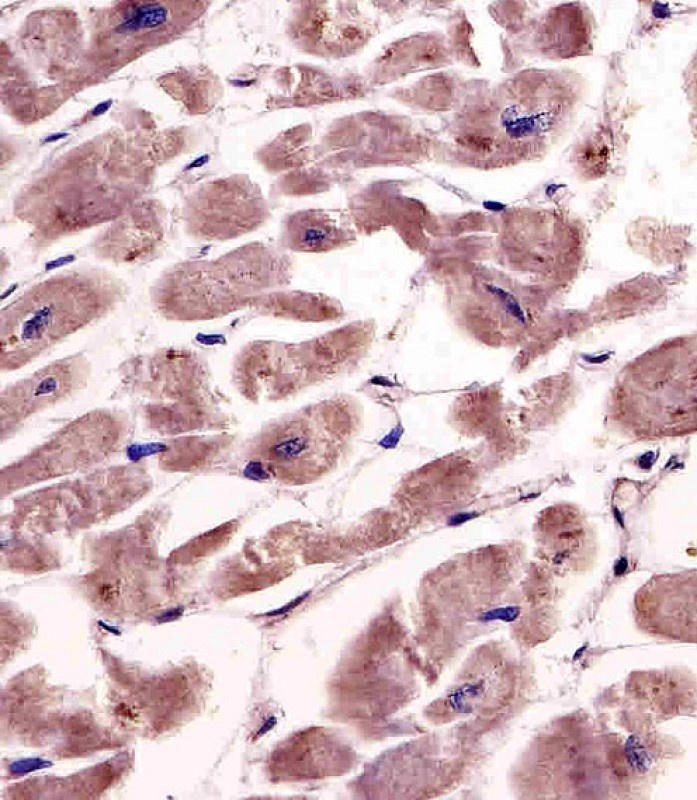 SPHK1 Antibody