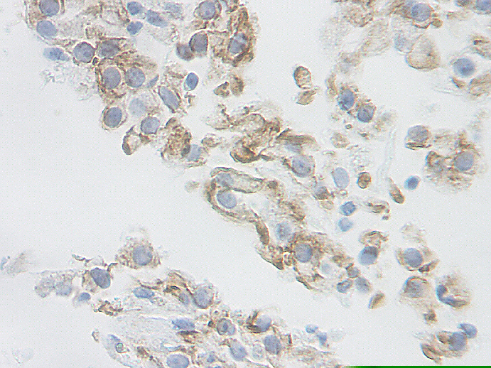 TRAIL Antibody [1.1_1A7-2B7]