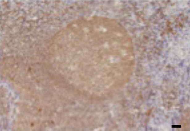 Eotaxin-2 Antibody [1.1_6C7-2C5]