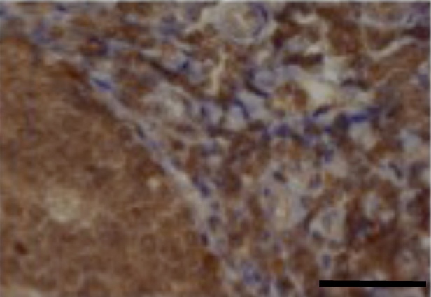 Eotaxin-2 Antibody [1.1_6C7-2C5]