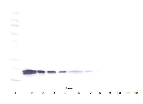 VEGF Antibody