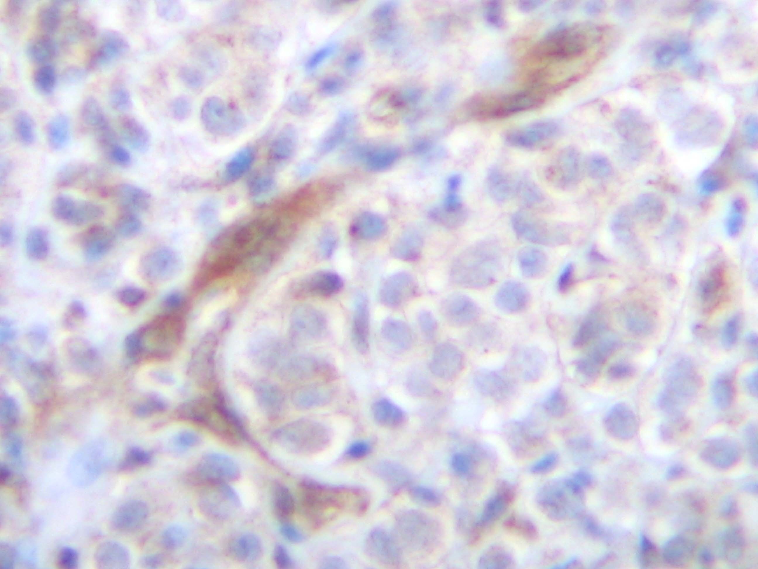 TRAIL Antibody