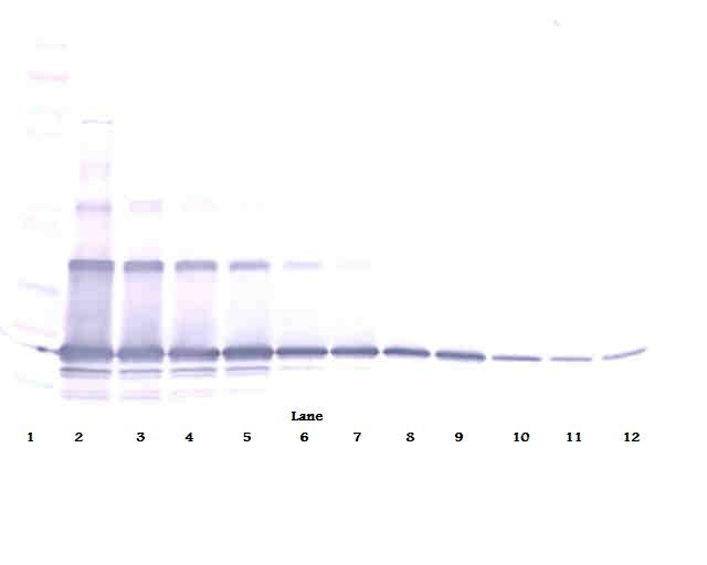 sRANK Ligand Antibody