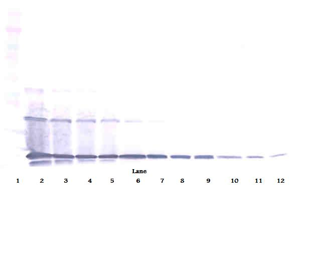 sRANK Ligand Antibody