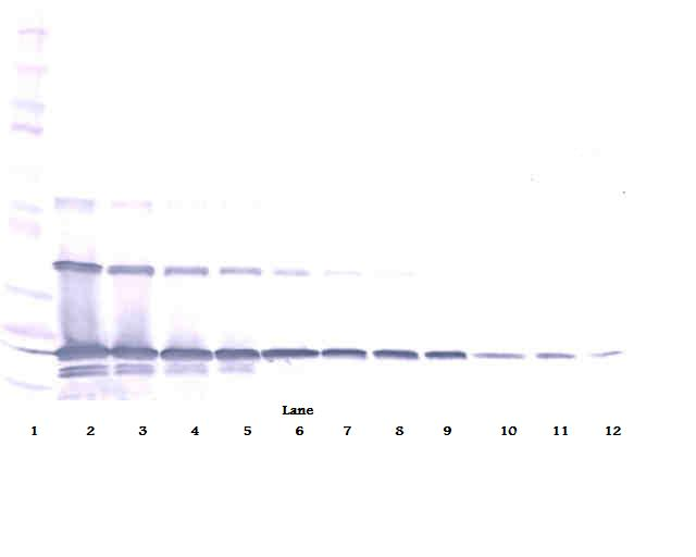 sRANK Ligand Antibody (biotin)