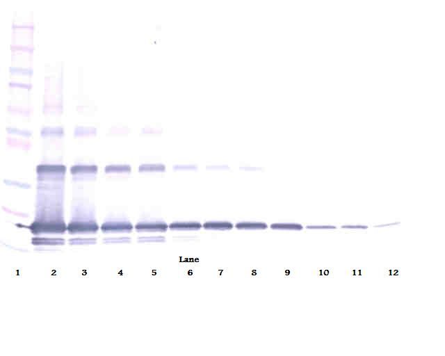 sRANK Ligand Antibody