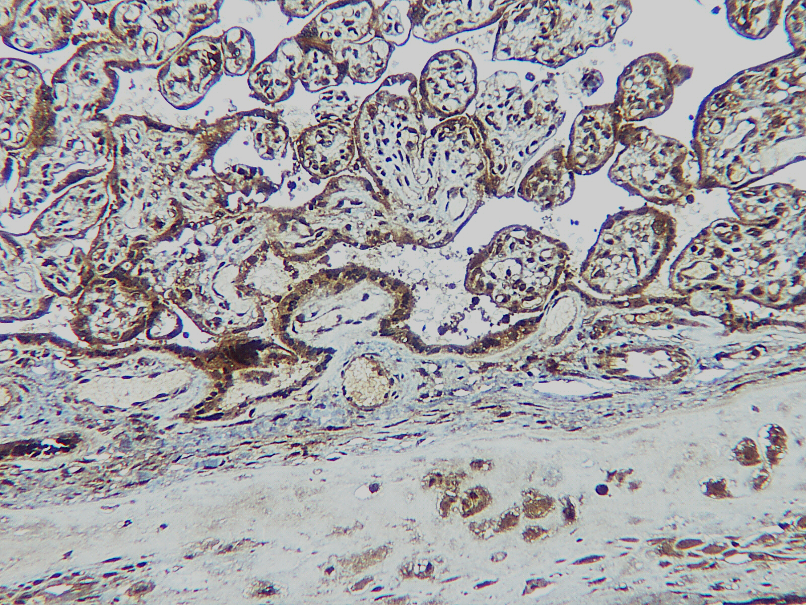 LIGHT Antibody