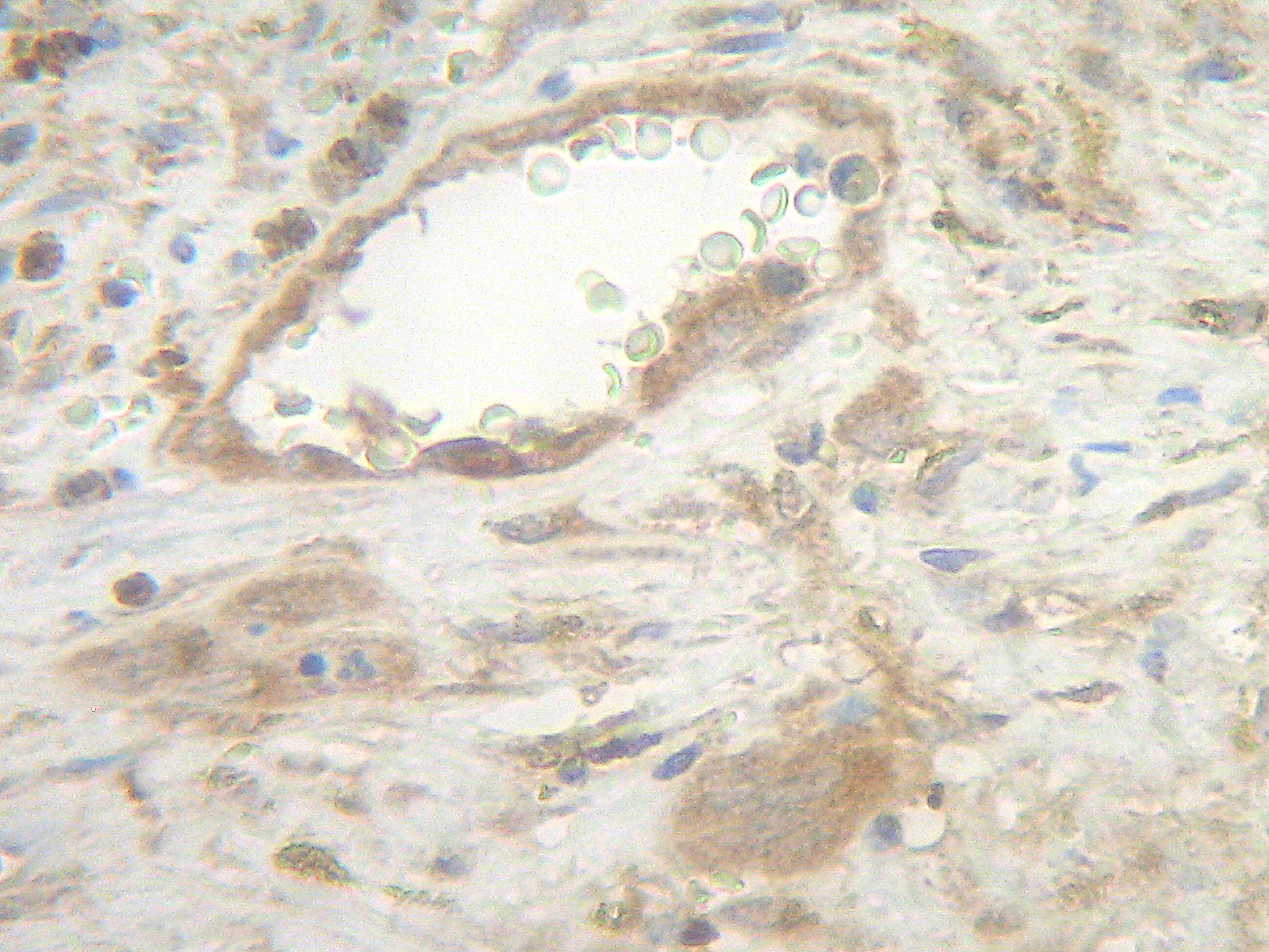 Fas Ligand Antibody