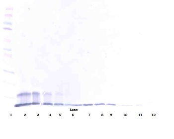 sTRAIL Rec-2 Antibody (biotin)