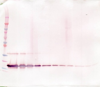 sTNF-receptor II Antibody