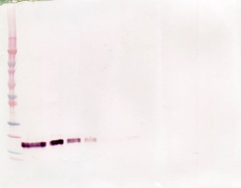 sTNF-receptor II Antibody