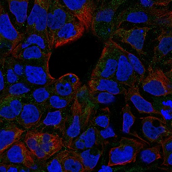sTNF-receptor II Antibody