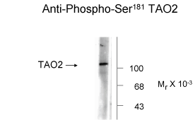TAO2 (phospho Ser181) Antibody