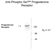 Progesterone Receptor (phospho Ser294) Antibody [608]