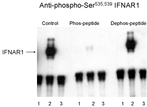 Interferon-a Receptor (phospho Ser535 / 539) Antibody