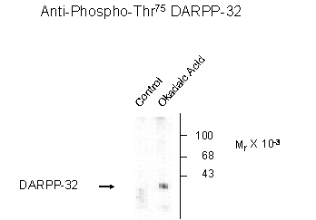 DARPP 32 (phospho Thr75) Antibody