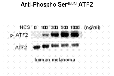 ATF2 (phospho Ser 490 / 498) Antibody