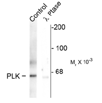 PLK1 (phospho Thr210 ) Antibody