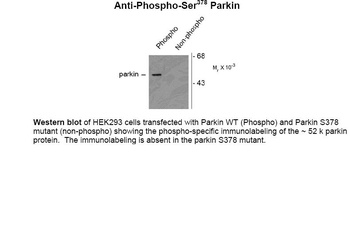 Parkin (phospho Ser378) Antibody
