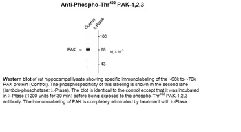 PAK1 (phospho Thr402) Antibody
