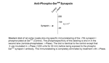 Synapsin (phospho Ser549) Antibody