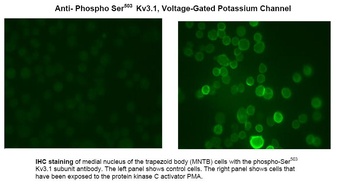 Potassium Channel (phospho Ser503) Antibody