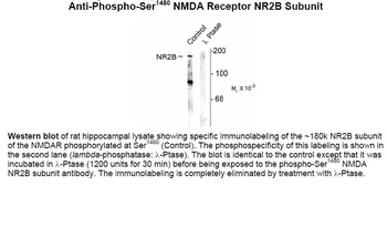 NMDA (phospho Ser1480) Antibody