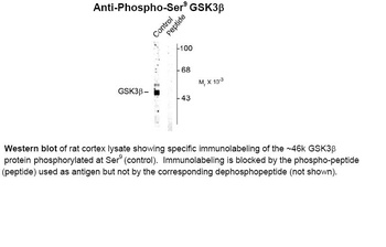 Glycogen synthase (phospho Ser9) Antibody