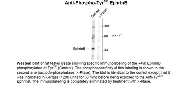EphrinB (phospho Tyr331) Antibody