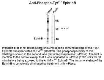 EphrinB (phospho Tyr317) Antibody