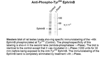 EphrinB (phospho Tyr298) Antibody