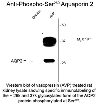 Aquaporin 2 (phospho Ser 269) Antibody