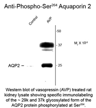 Aquaporin 2 (phospho Ser264) Antibody