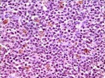 MCL1 Antibody [8C6D4B1]