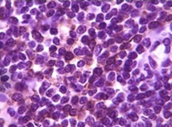 BLK Antibody [9D10B7H6 / 9D10A8F8]