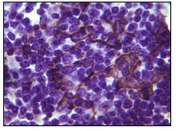 BLK Antibody [9D10D1]