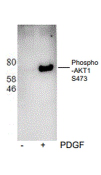 AKT1 (phospho S473) Antibody [H4]
