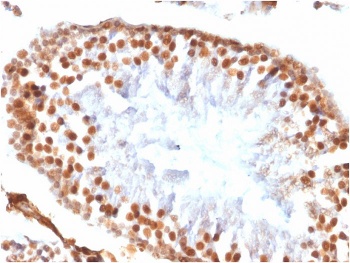 Recombinant Wilms Tumor 1 Antibody [WT1/1434R]