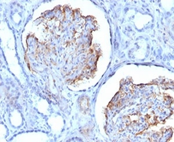 Recombinant WT1 Antibody [RMWT1-1]