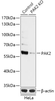 PAK2 Antibody, KO Validated