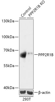 PPP2R1B Antibody, KO Validated