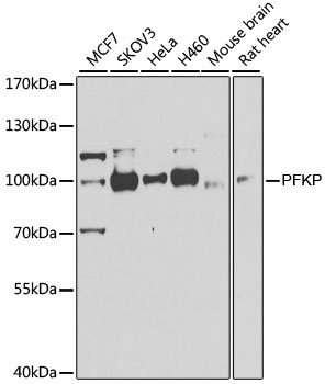 PFKP Antibody, KO Validated