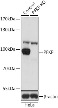 PFKP Antibody, KO Validated