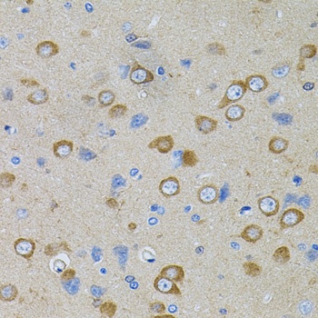 PFKP Antibody, KO Validated
