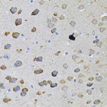 PFKP Antibody, KO Validated